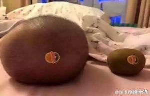 大小猕猴桃-1