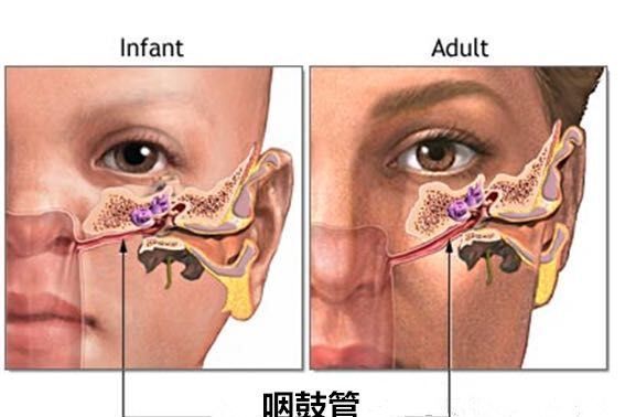 咽鼓管堵塞的几大症状 咽鼓管堵塞的几大症状