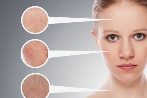 美白祛斑产品效果好的护肤品？谁能推荐几款？-3