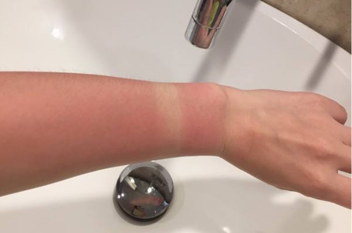 科普时间——紫外线是如何伤害你皮肤的 科普时间——紫外线是如何伤害你皮肤的