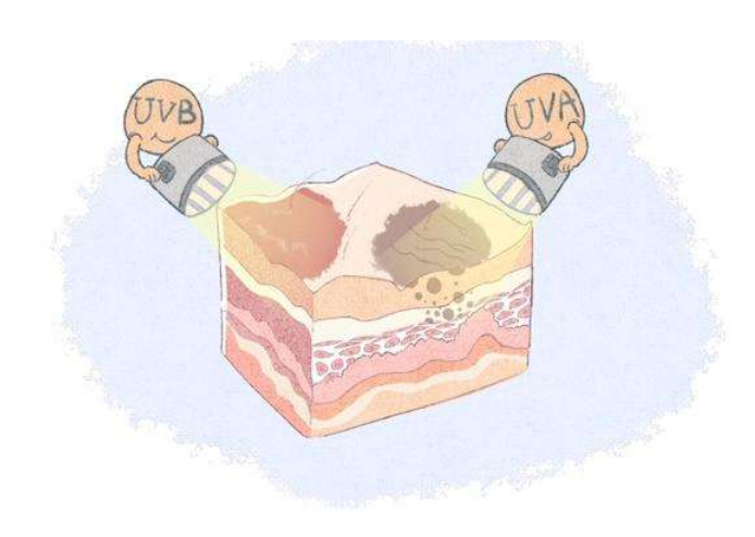 科普时间——紫外线是如何伤害你皮肤的 科普时间——紫外线是如何伤害你皮肤的