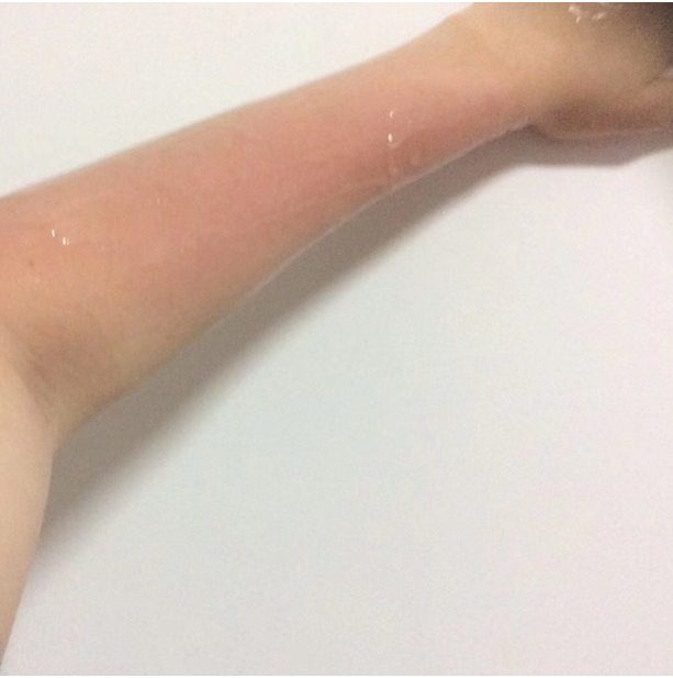 开春就被晒伤?如何选择防晒霜来拯救你的肌肤 开春就被晒伤?如何选择防晒霜来拯救你的肌肤