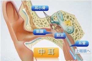 耳朵突然疼是怎么回事？这些细节不能大意!-1