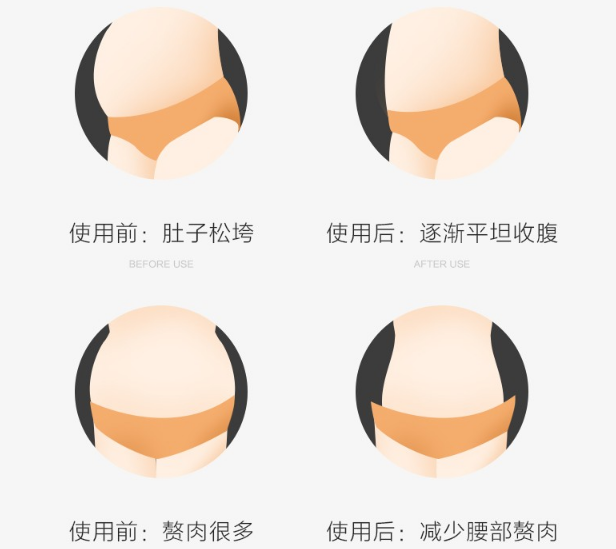 产后也要好身材 束腹带功不可没 产后也要好身材 束腹带功不可没