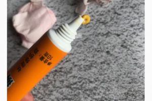 祛痘药膏哪个好？祛痘药膏值得买吗？-1