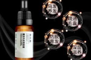 头发营养液有用吗？头发营养液哪个牌子好？-1