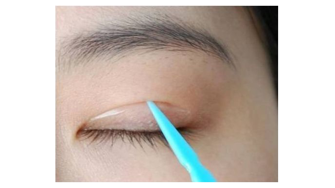 双眼皮贴贴久了有害吗 双眼皮贴的正确贴法 双眼皮贴贴久了有害吗 双眼皮贴的正确贴法