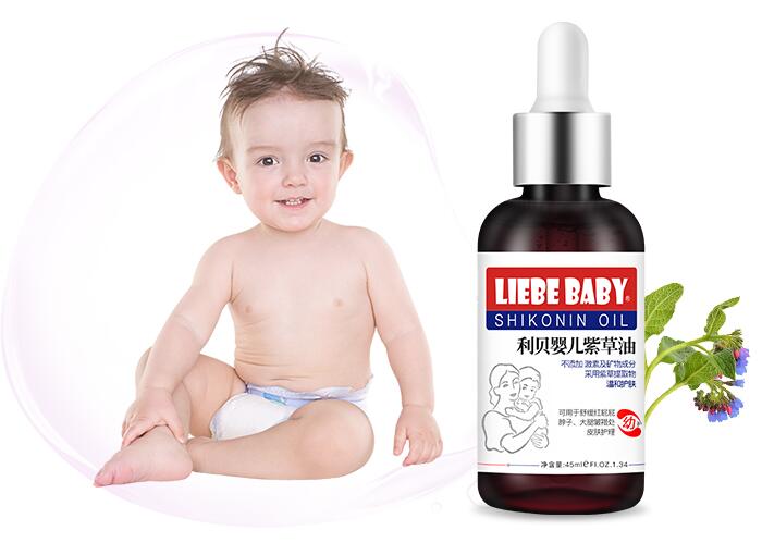 紫草油可以给婴儿用吗 紫草油的功效及使用注意事项