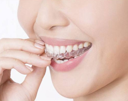 牙套有哪些类型 牙套使用要注意什么 牙套有哪些类型 牙套使用要注意什么