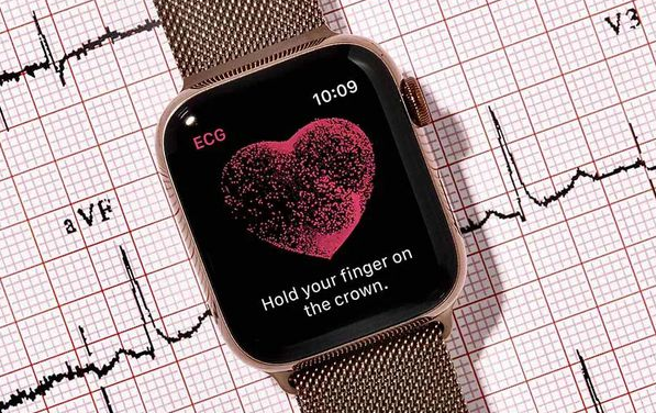 苹果国行版正式上线 ECG 功能，健康信息一目了然